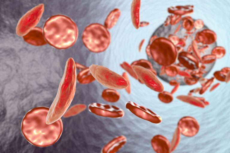 Stargardt Disease
