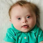 Genetic disorder Down syndrome