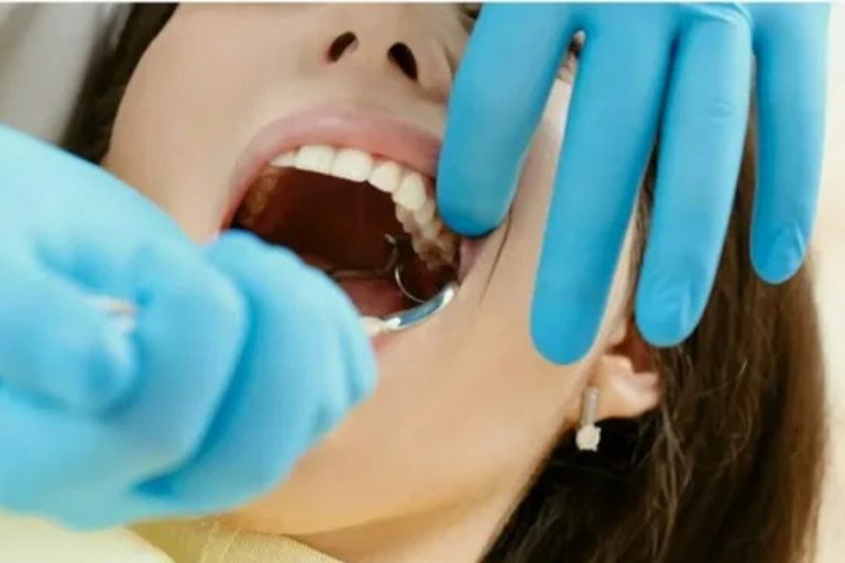 Removing wisdom teeth
