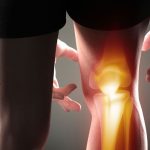 Arthritis