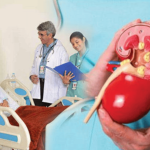 Organ Transplants