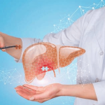 WHO Hepatitis D Cancer Classification