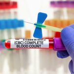 CBC Test Simplified