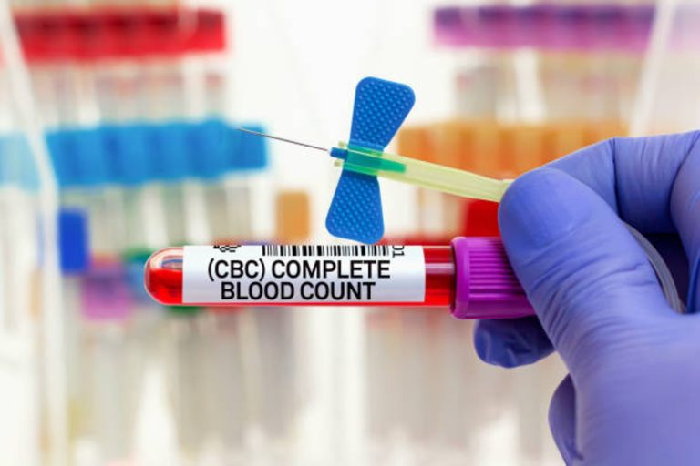 CBC Test Simplified