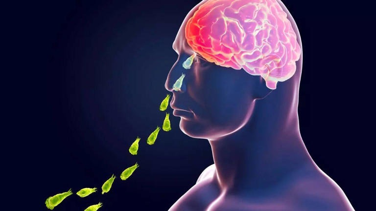 Brain-Eating Amoeba Kerala: A New Public Health Challenge Brain-Eating Amoeba Kerala