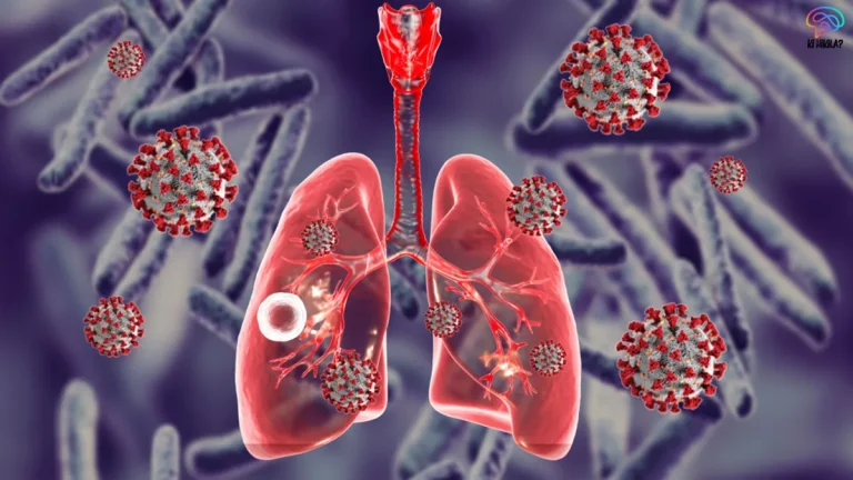 Tuberculosis Genetic Link in Sahariya Tribe