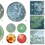 Bistable Gene Expression Pseudomonas