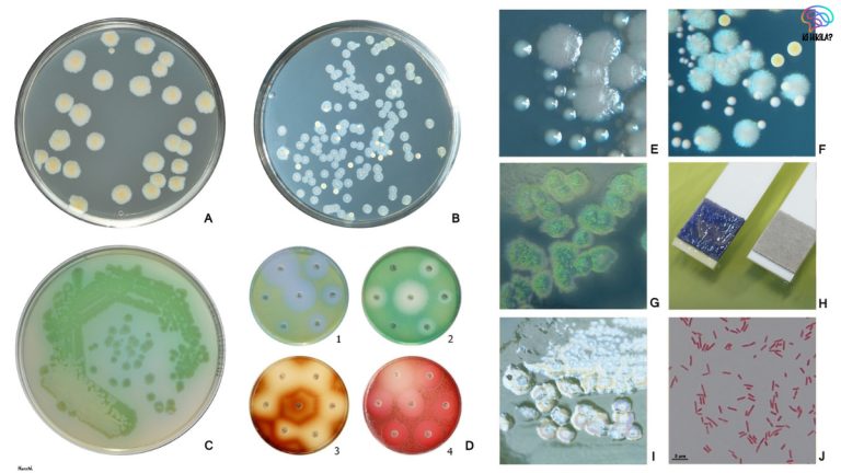 Bistable Gene Expression Pseudomonas