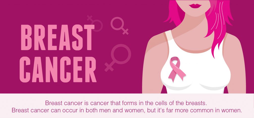 breast cancer