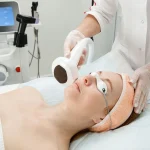 Laser Skin Tightening Melbourne