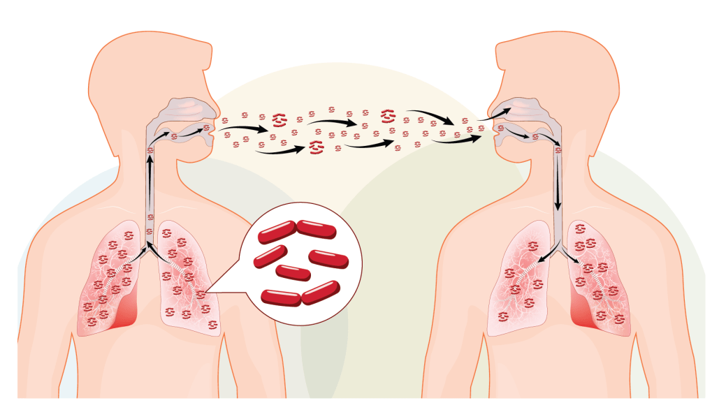 India TB Cases