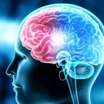 AIIMS Brain Stent Trial