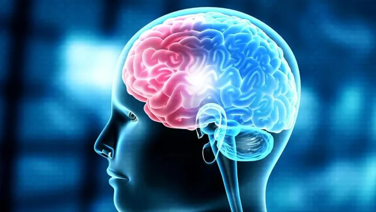 AIIMS Brain Stent Trial