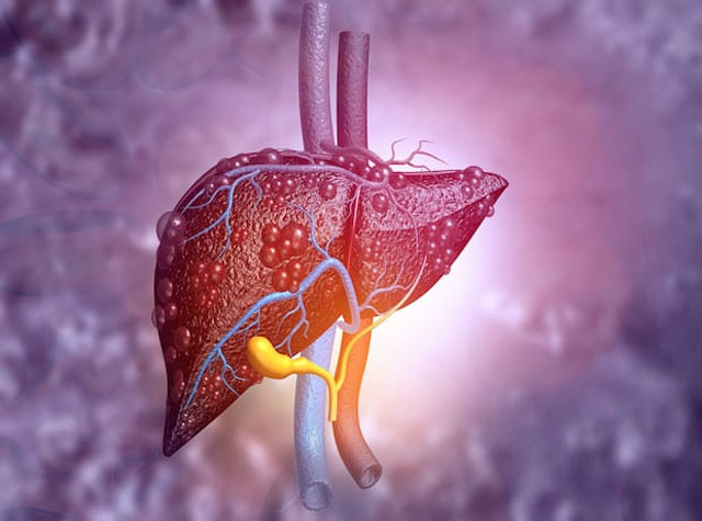Monoclonal Antibody PSC Treatment