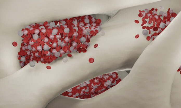 Cancer Reprogrammes Immunity