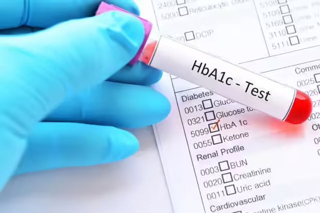 HbA1c Accuracy India Under Scrutiny as New Study Flags Diagnostic Risks Plan Bee HbA1c Accuracy India