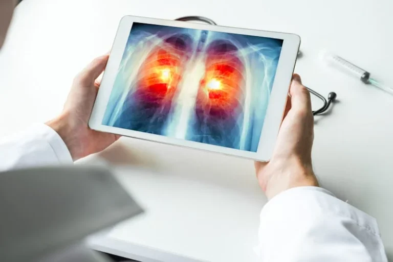 India Lung Cancer Guidelines
