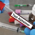 Alzheimer’s Blood Test Protein