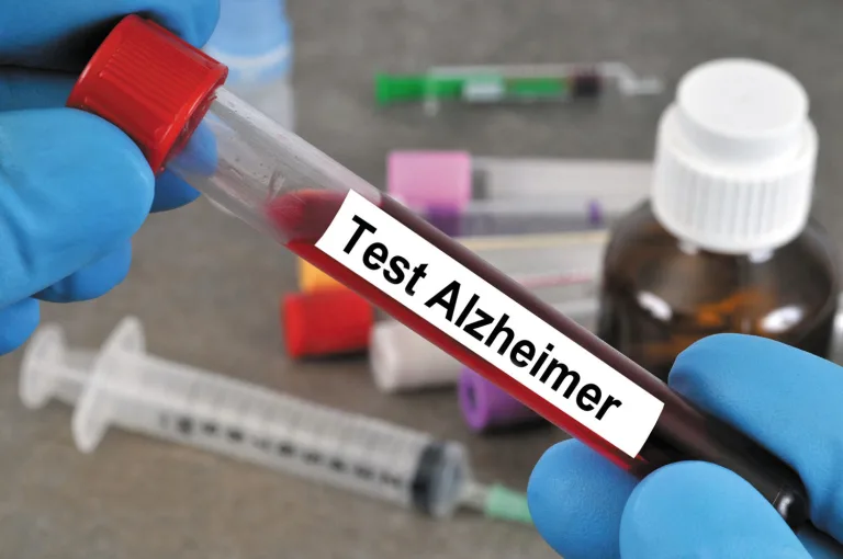 Alzheimer’s Blood Test Protein