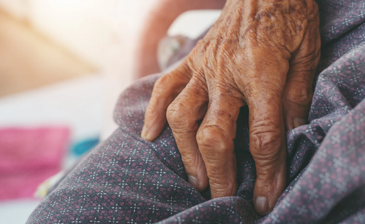 Chile Eliminates Leprosy WHO Verification: A Historic Public Health Achievement Chile Eliminates Leprosy WHO