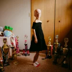 Progerinin Therapy Progeria