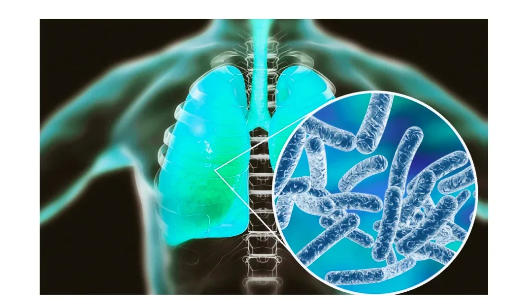 Urban Water Legionnaires Surge