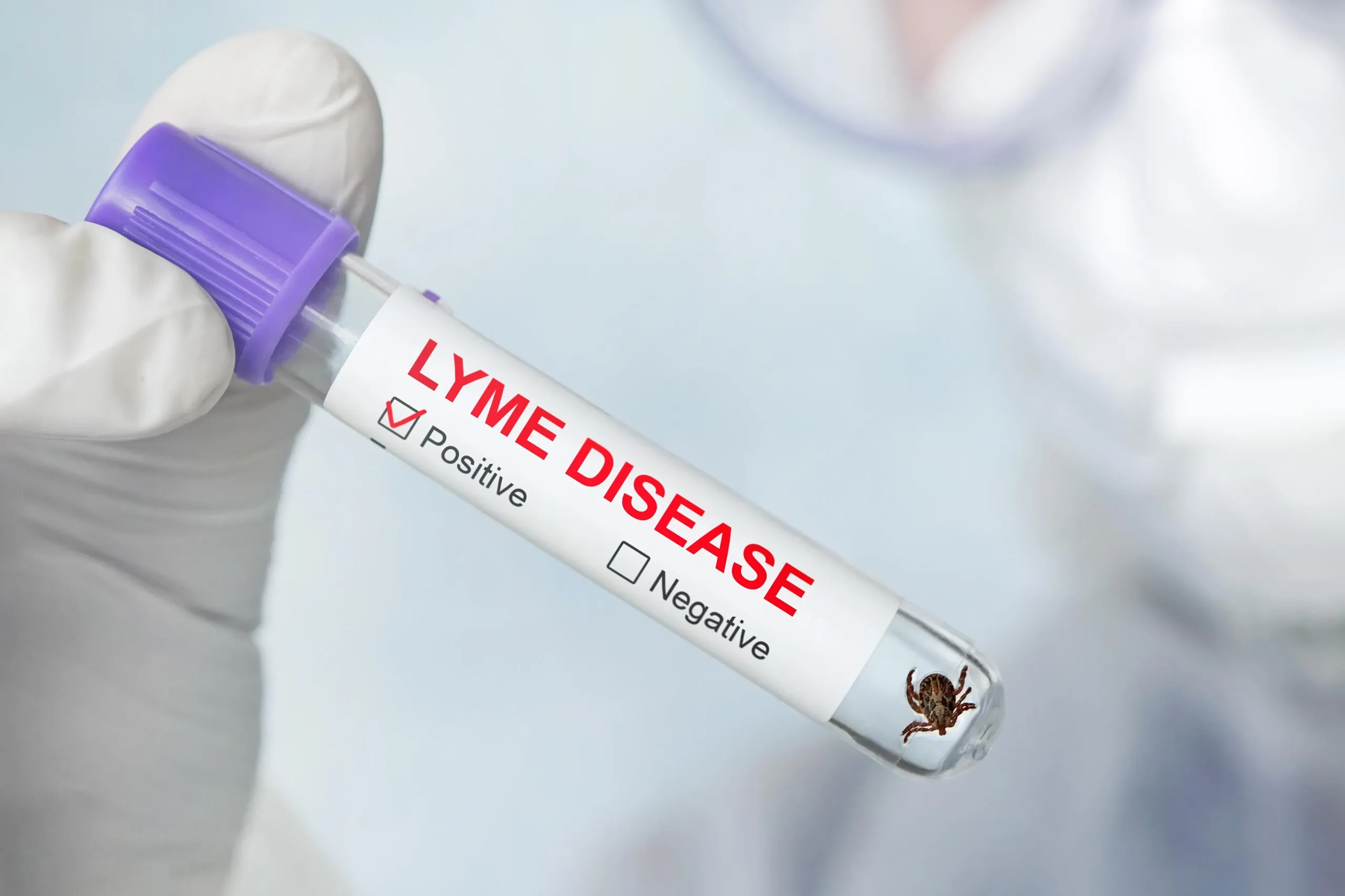 Lyme Vaccine Trial Success