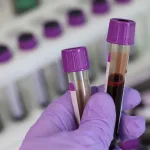 PFAS in Human Blood