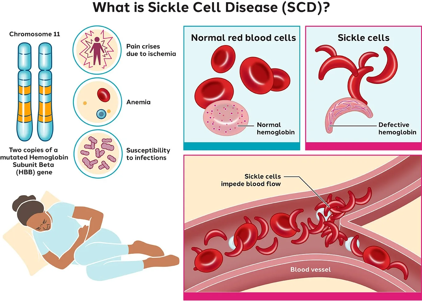 Sickle Cell Mission