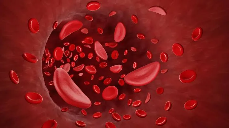 Sickle Cell Mission