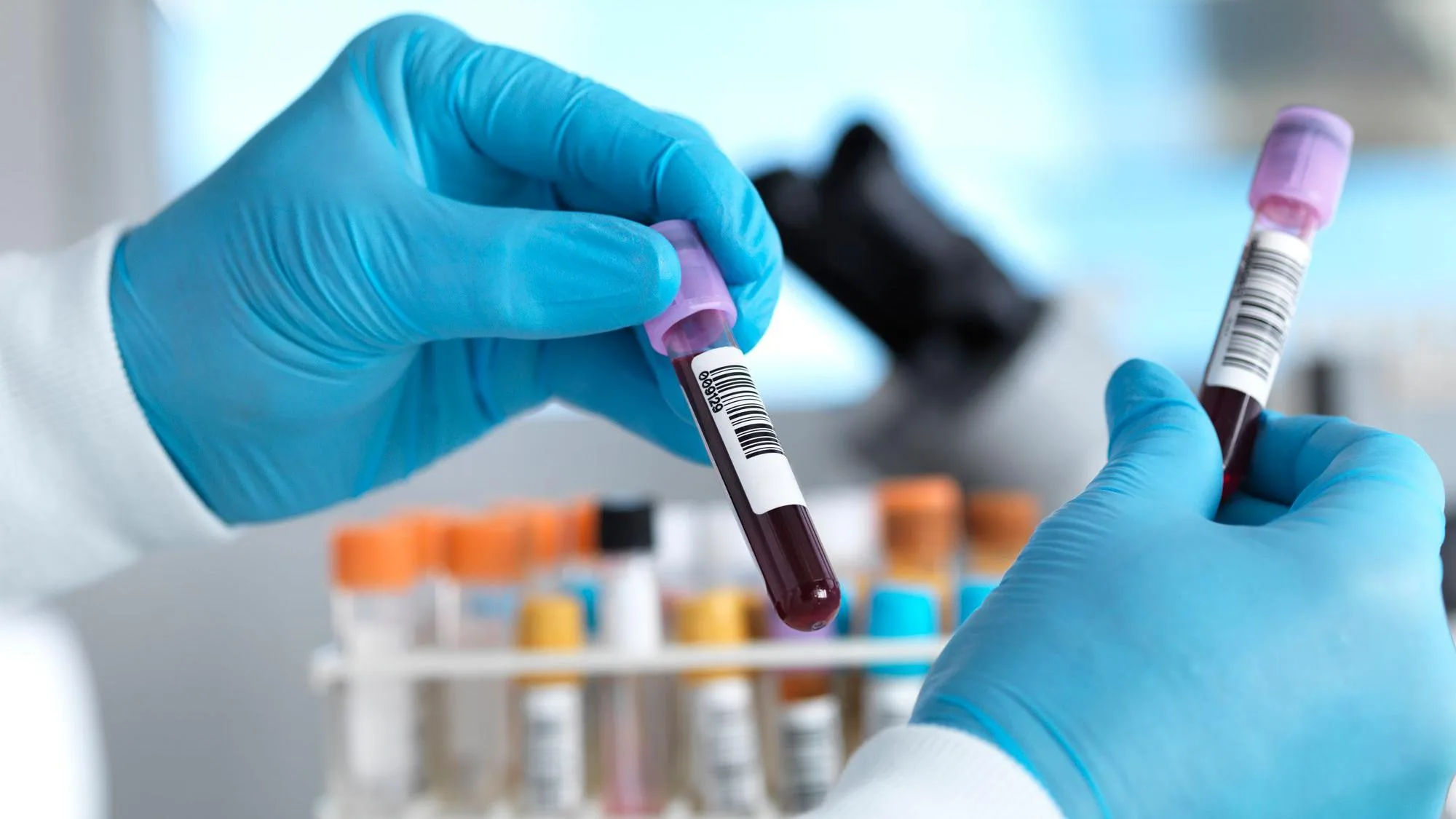 Ebola Bundibugyo 