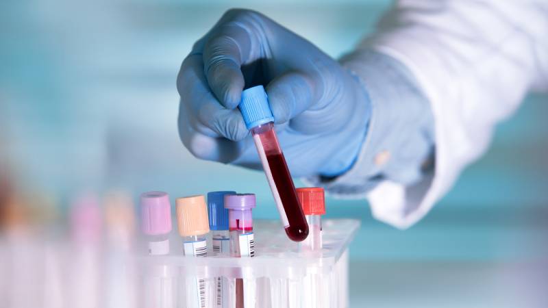 TNBC Blood Test